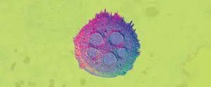 Colorful microscopic view of a plant cell with a spiky exterior against a yellow background.